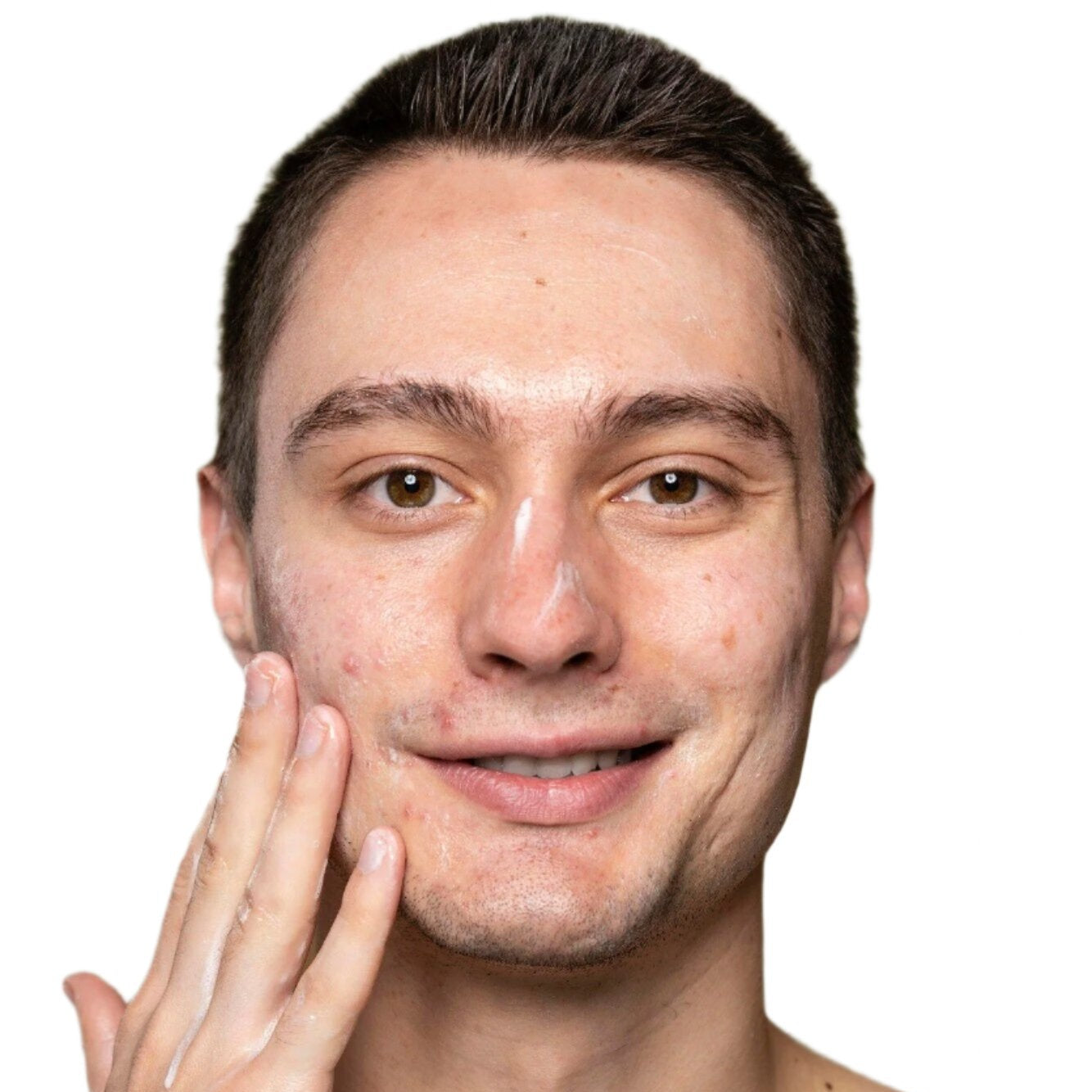 white young man brown hair control acne serum dermal essentials medical grade skincare