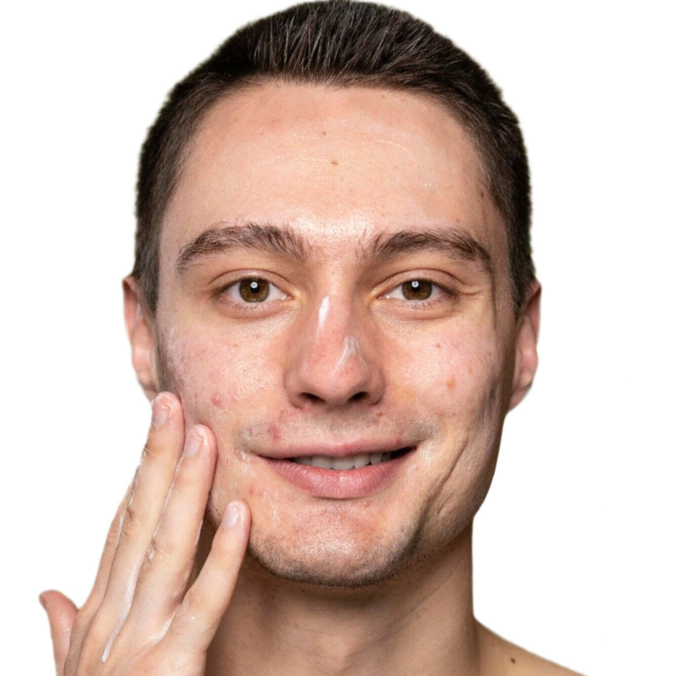 white young man brown hair control acne serum dermal essentials medical grade skincare