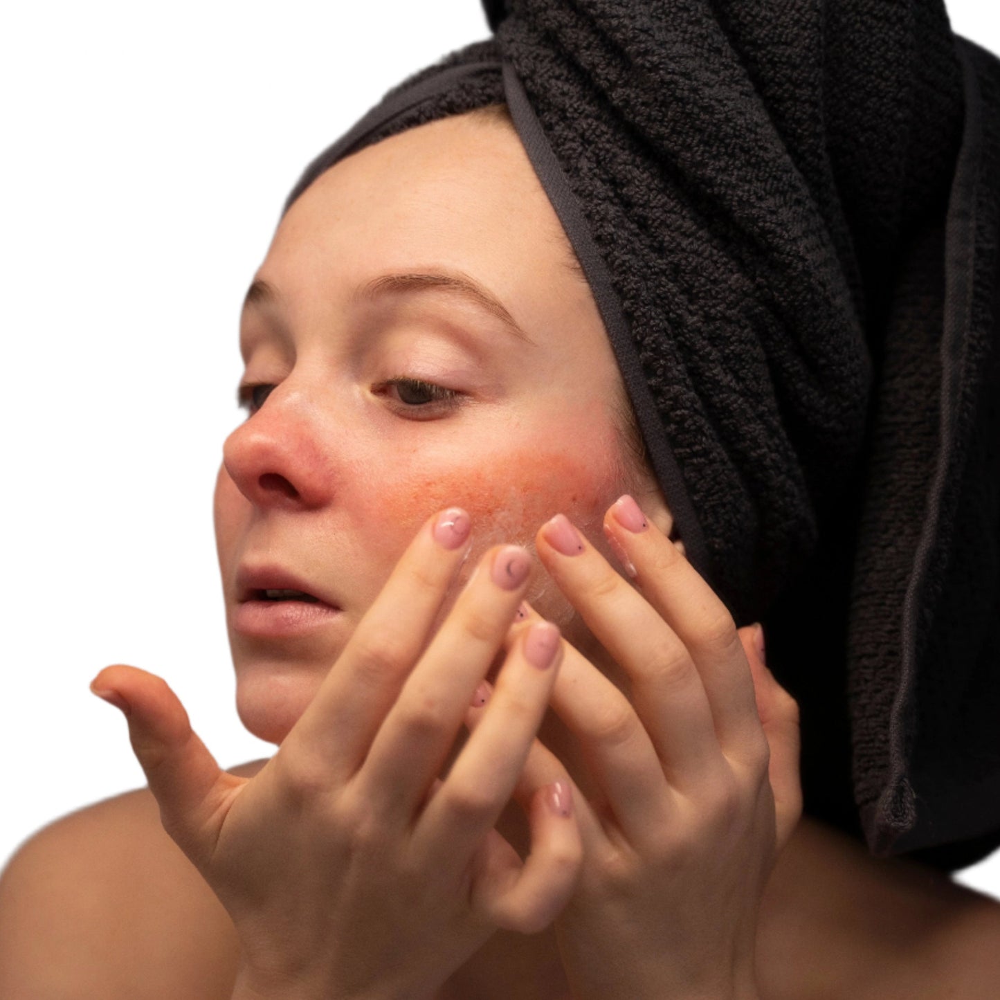 white woman black head towel red cheeks dermal essentials medical grade skincare