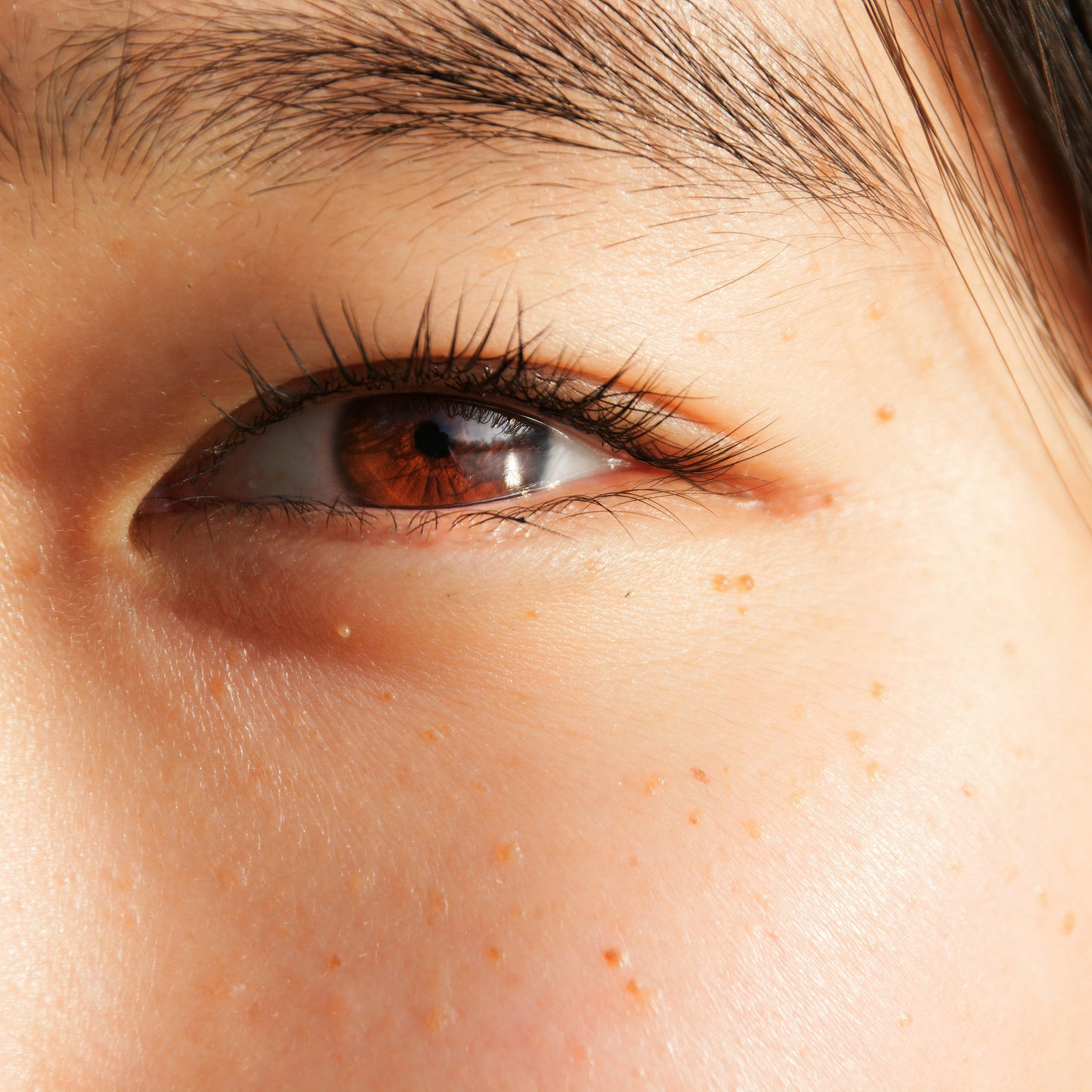 asian woman brown hair eye area dermal essentials medical grade skincare