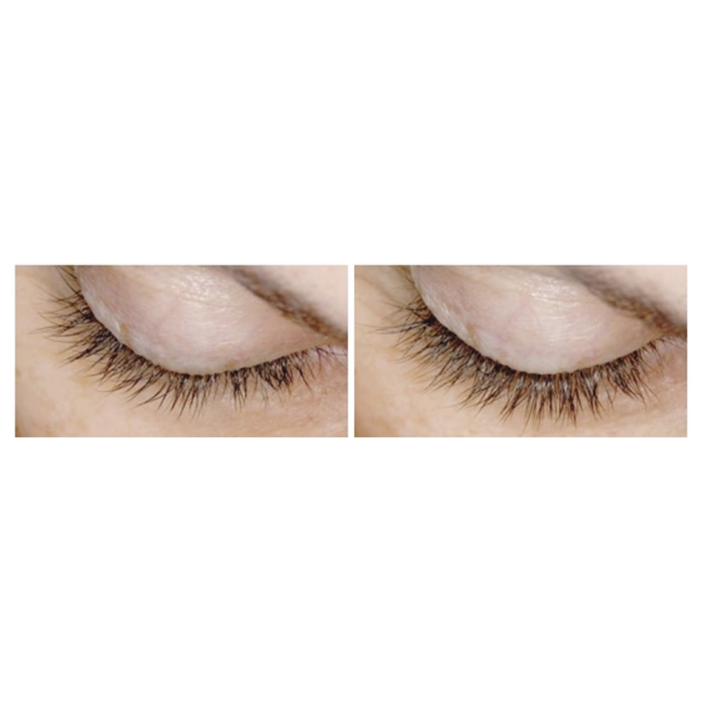 Two eyelash before and after results Grow lash and brow serum for longer, fuller lashes Dermal Essentials Medical Grade Skincare