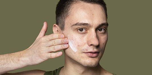 adult acne: why breakouts don’t stop after your teens