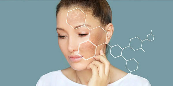 hyperpigmentation and dark spots: what causes them and how to treat them