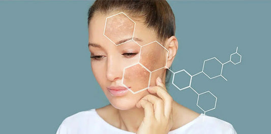 hyperpigmentation and dark spots: what causes them and how to treat them
