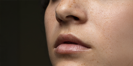 how to improve skin texture: a dermal essentials guide for smoother, healthier skin