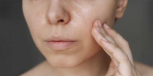 skincare routine for acne-prone and oily skin: what actually works