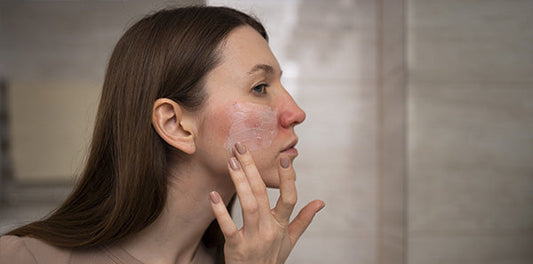 sensitive skin routine: how to calm redness & irritation effectively
