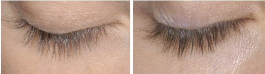 white woman brown eyelashes. before and after lash serum dermal essentials medical grade skincare