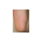 One smooth foot heel image. Baby Foot exfoliating original foot peel Dermal Essentials Medical Grade Skincare