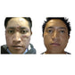 before and after Acne Defense Kit with 4-step skincare products for acne-prone skin.