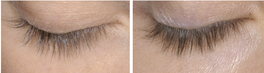 Two before and after lash results Grow lash and brow serum for fuller, longer lashes Dermal Essentials Medical Grade Skincare